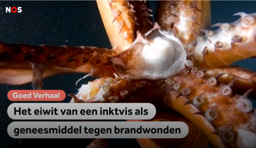 Het eiwit van een inktvis als geneesmiddel tegen brandwonden